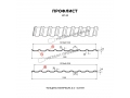 Профлист Металл Профиль МП-20x1100-R (ПЭ-01-9003-0,4)